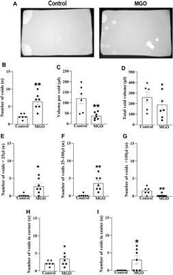 TRPA1 channel mediates methylglyoxal-induced mouse bladder dysfunction